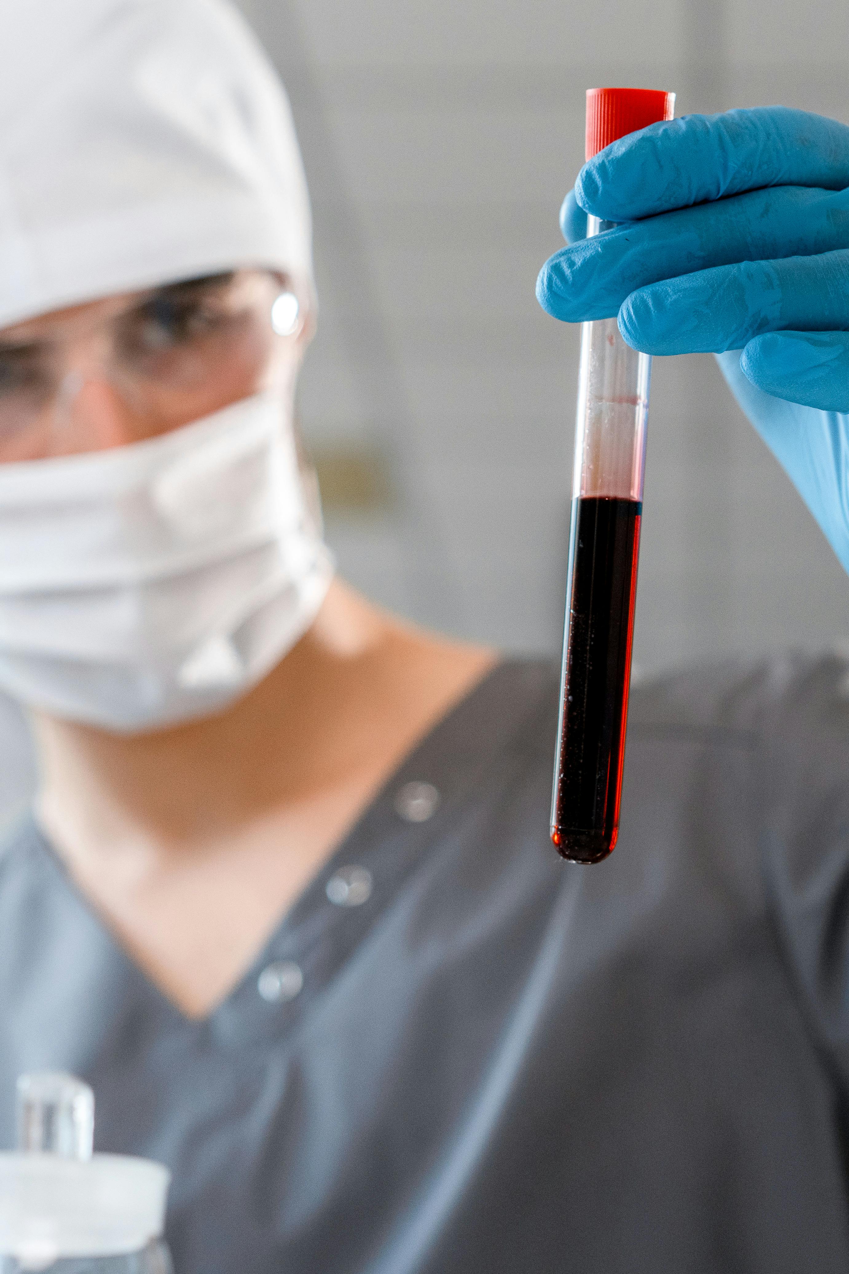IVDR training - Man looking at test tube of blood